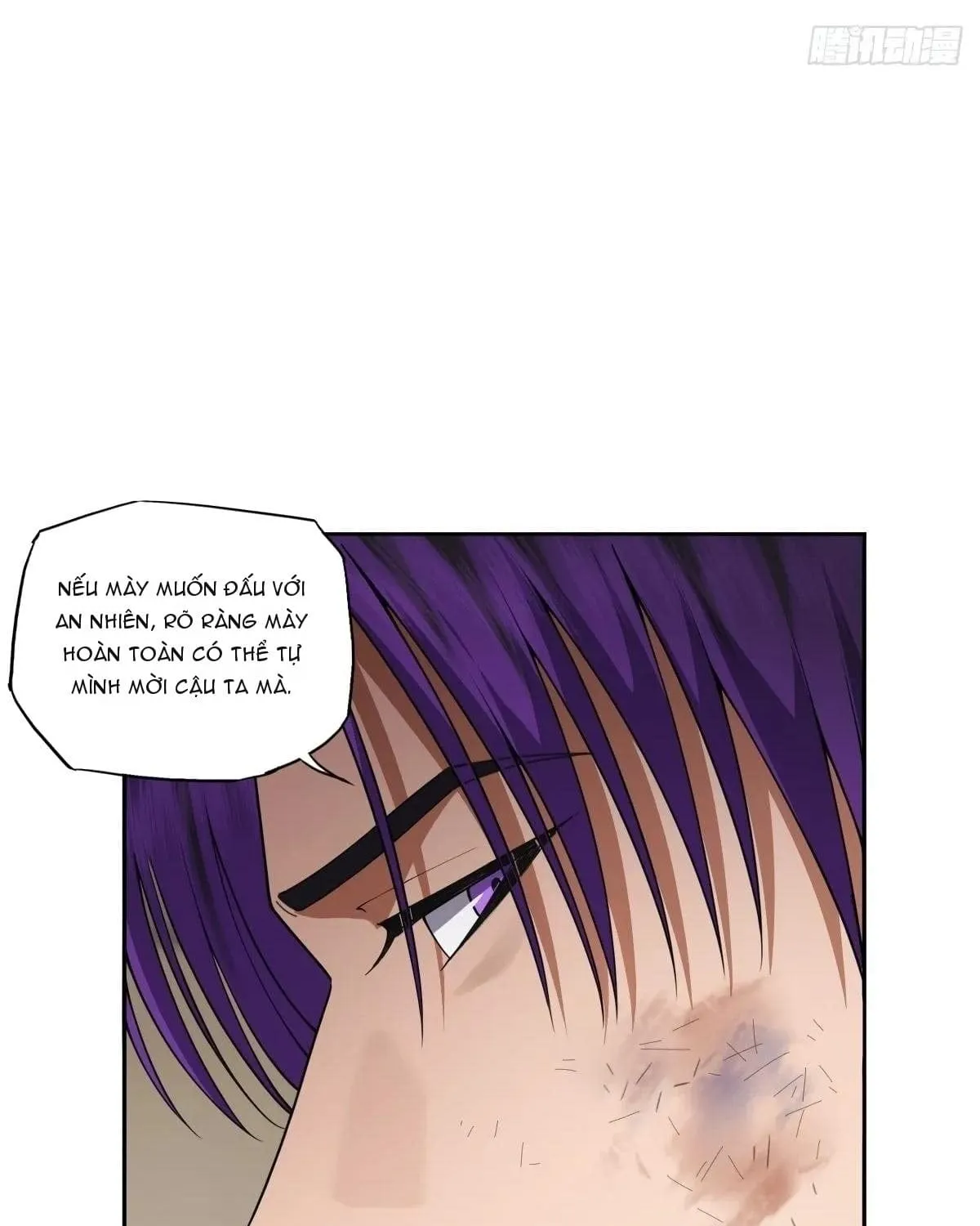 Anh Trai Tôi Là Một Con Chó Điên Chap 22 - Next Chap 23