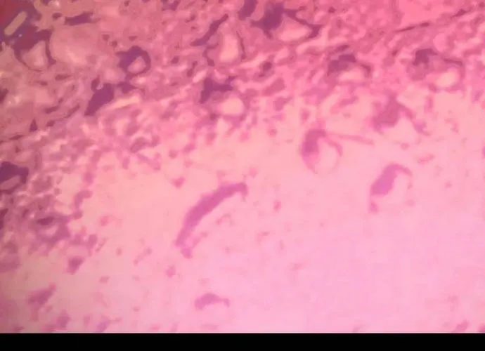 đối Mặt Với Bệnh Tâm Thần, Ma Quỷ Chẳng Là Cái Thá Gì Chap 171 - Next Chap 172