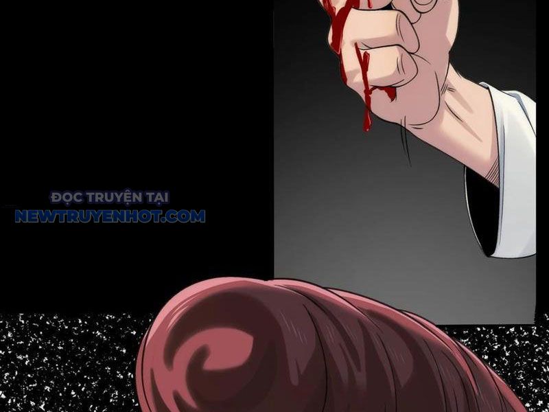 đối Mặt Với Bệnh Tâm Thần, Ma Quỷ Chẳng Là Cái Thá Gì Chap 73 - Next Chap 74