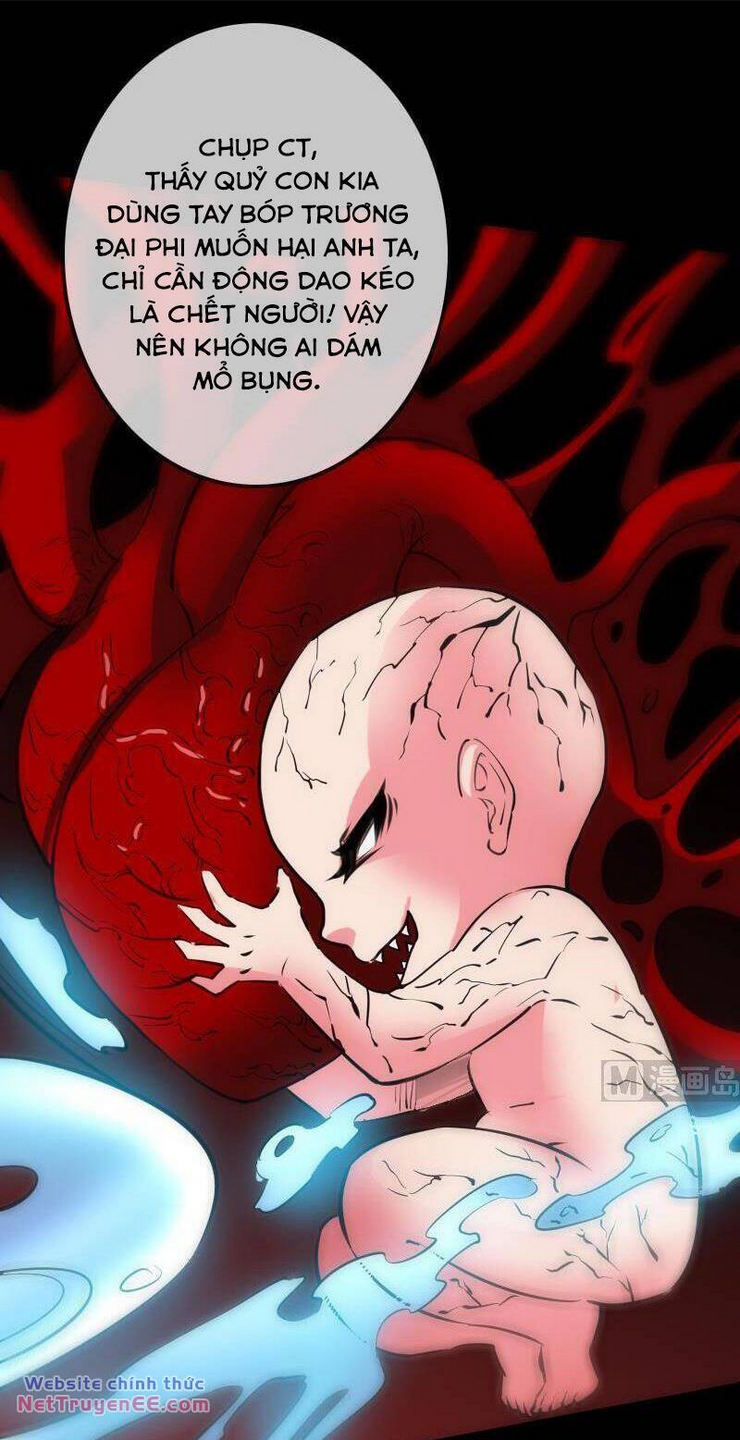 Kiếp Thiên Vận Chap 121 - Next Chap 122