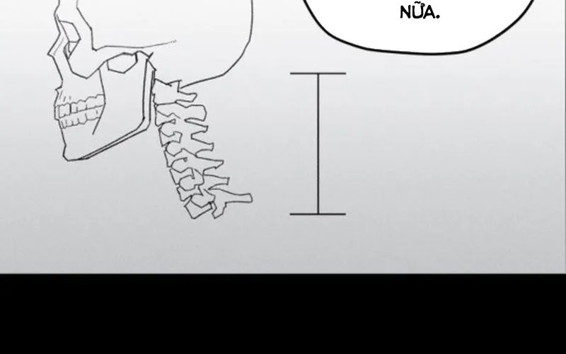 Lây Nhiễm - Làm Sóng Zombie Chap 5 - Next Chap 6