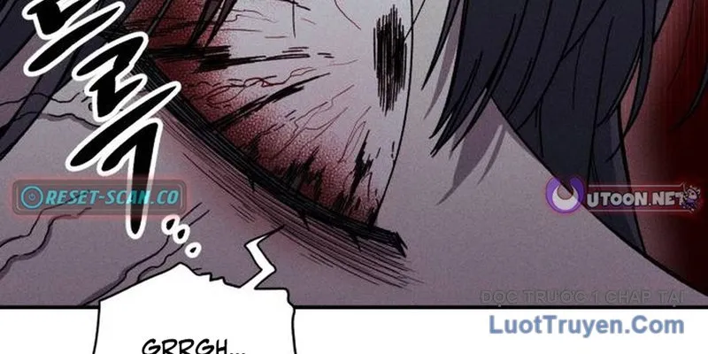 Lây Nhiễm - Làm Sóng Zombie Chap 8 - Next Chap 9