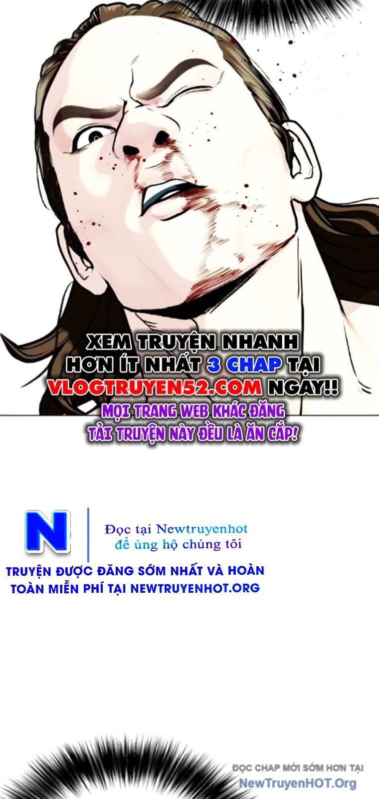 Loser Giỏi Võ Chap 133 - Next Chap 134