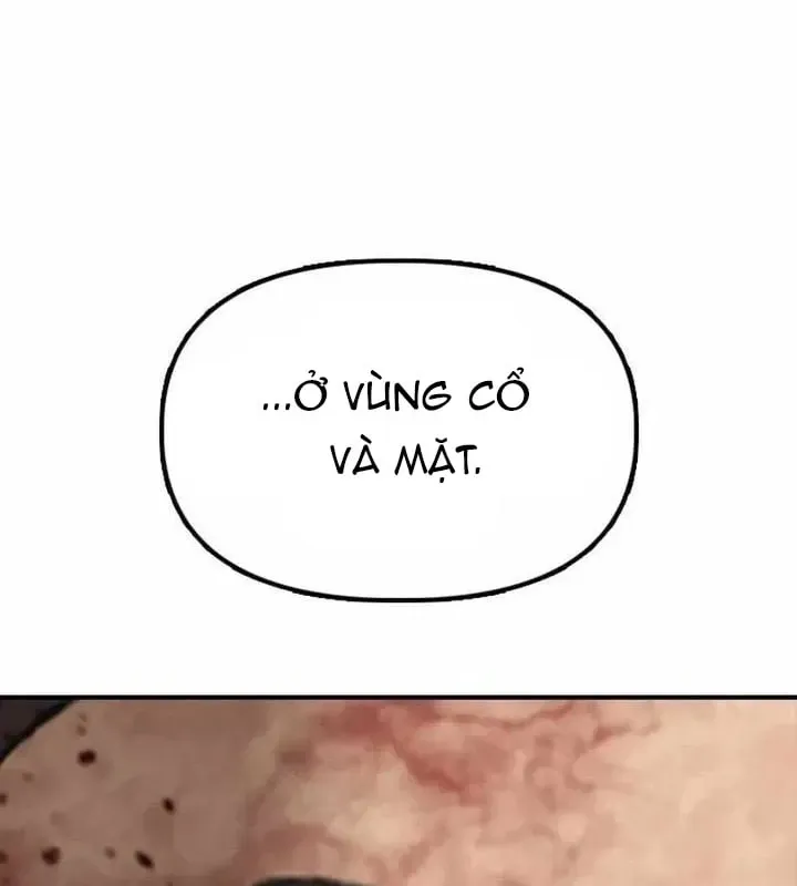 Ngày Tận Thế Đã Đến Chap 72 - Next Chap 73