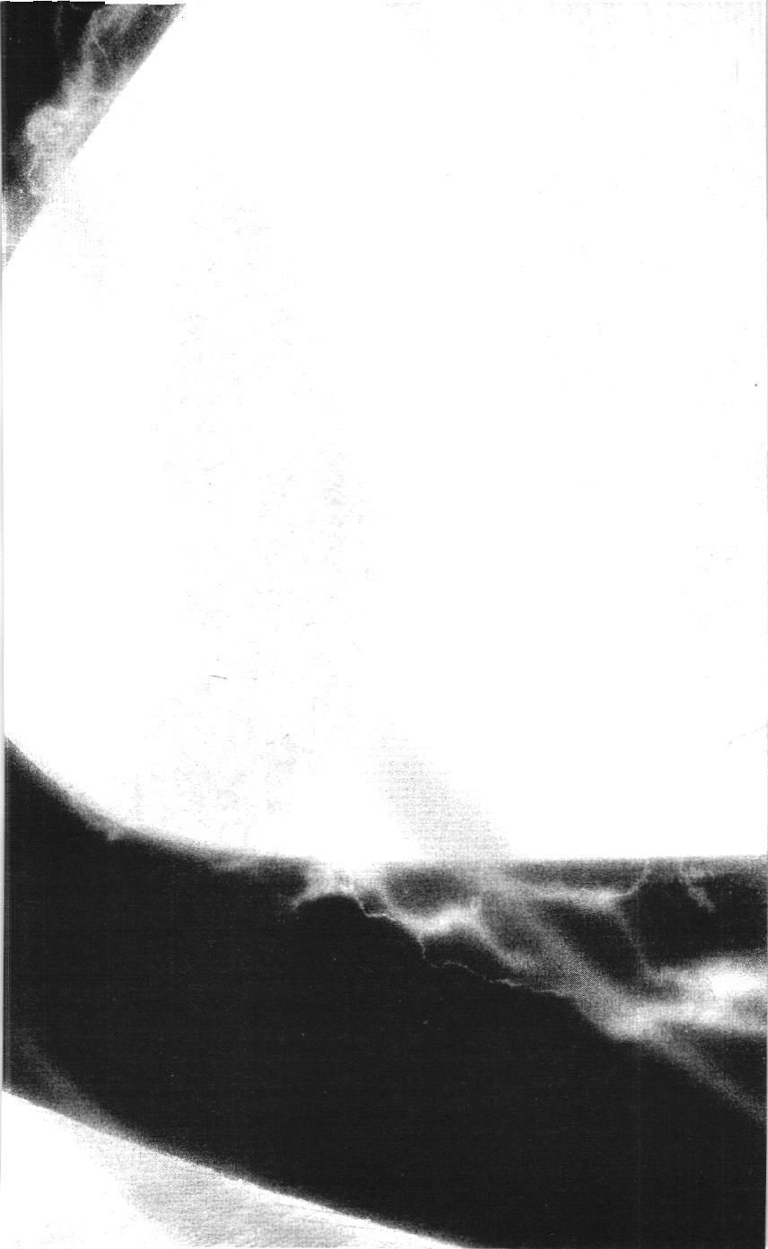 One-Punch Man (NXB Kim Đồng) Chap 36 - Next Chap 37