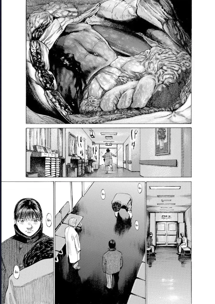 Say Hello To Black Jack Chap 115 - Next Chap 116