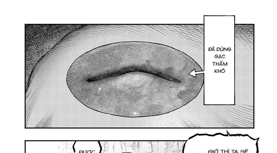 Tôi Dùng Y Học Hiện Đại Để Đối Đầu Với Ma Thuật Cổ Đại Chap 25 - Next Chap 26