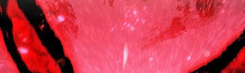 122